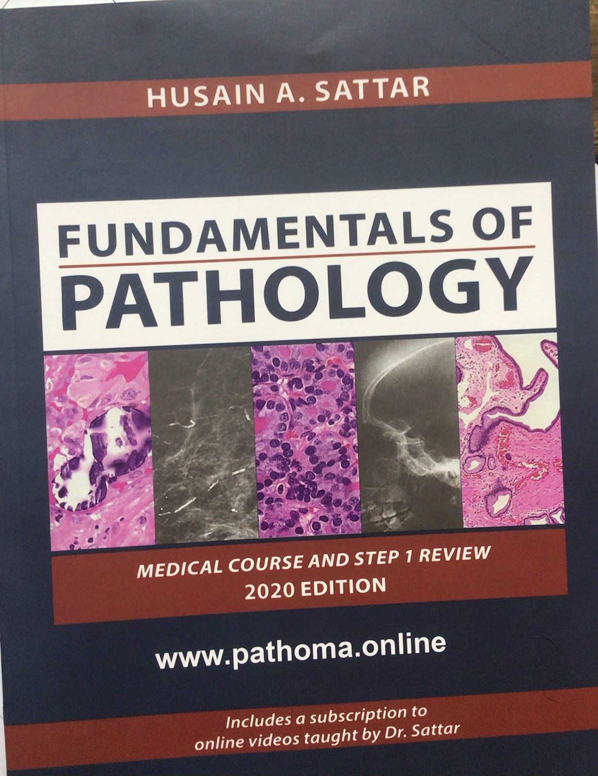 PATHOMA, FUNDAMENTALS OF PATHOLOGY BY DR SATTAR, INTERNATION… Husain Abdul Sat
